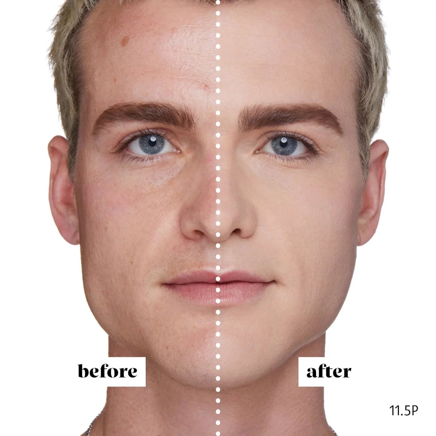 Sephora Concealer Best Skin Ever