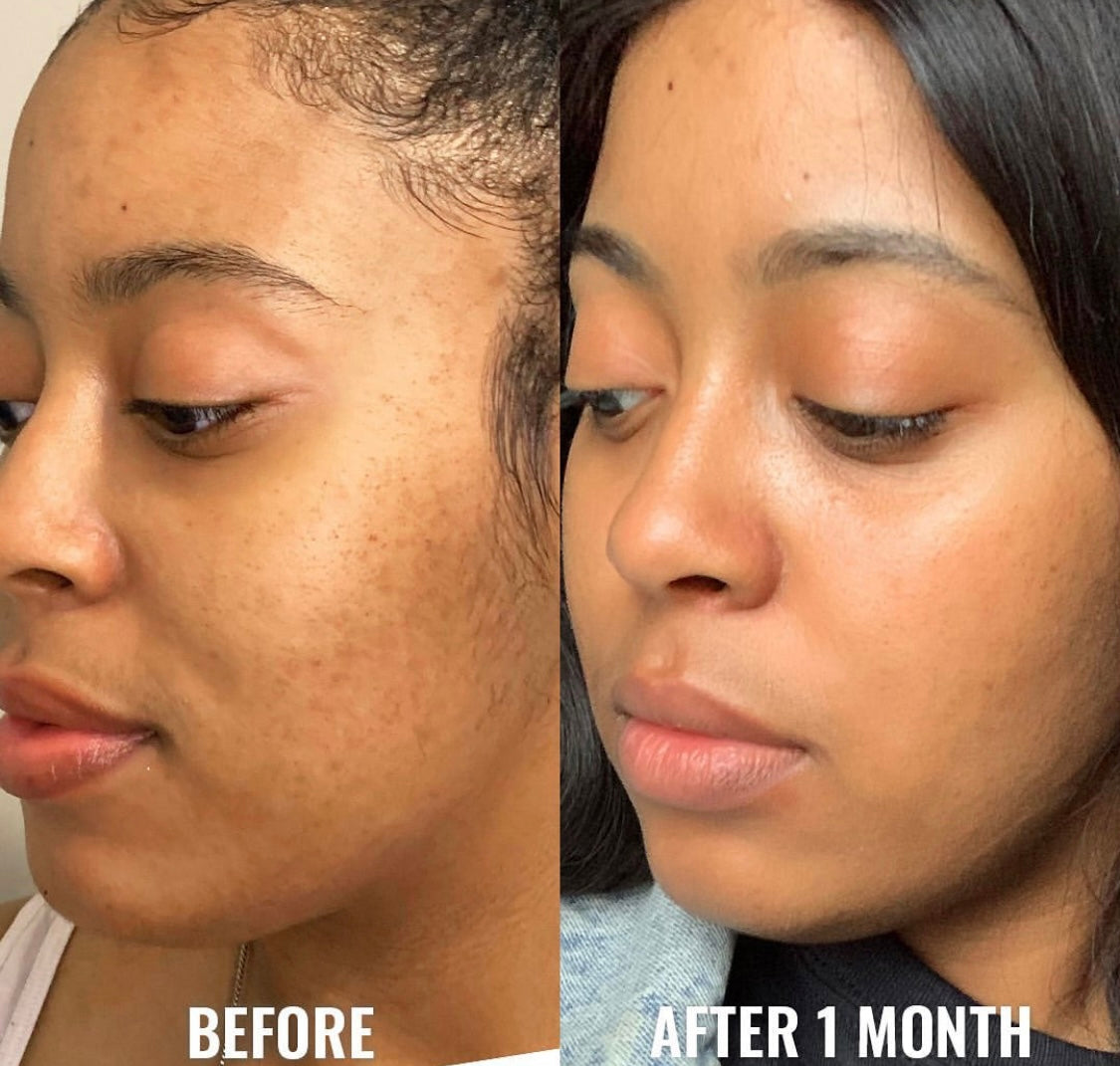 Tonico Exfoliante Acido Glicolico Good Molecules