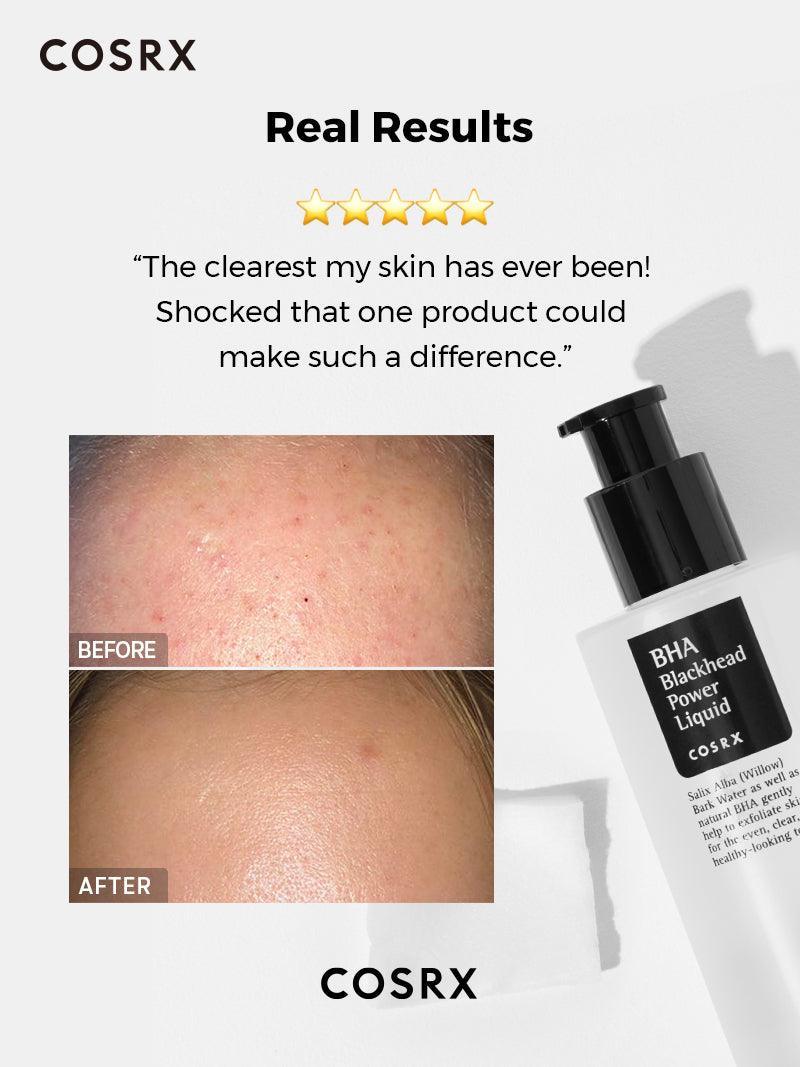 COSRX BHA Blackhead Liquid Exfoliant