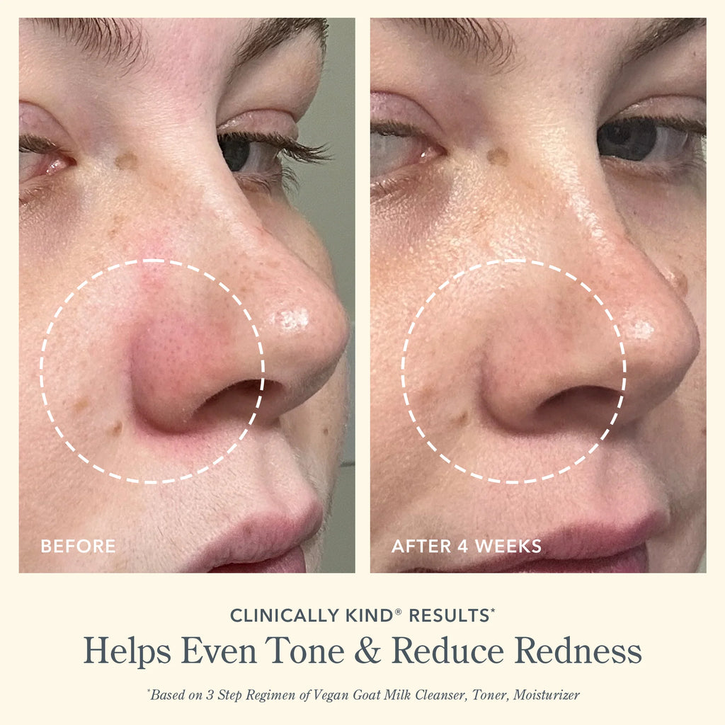 BEEKMAN Oily/Combination Skin Facial Toner