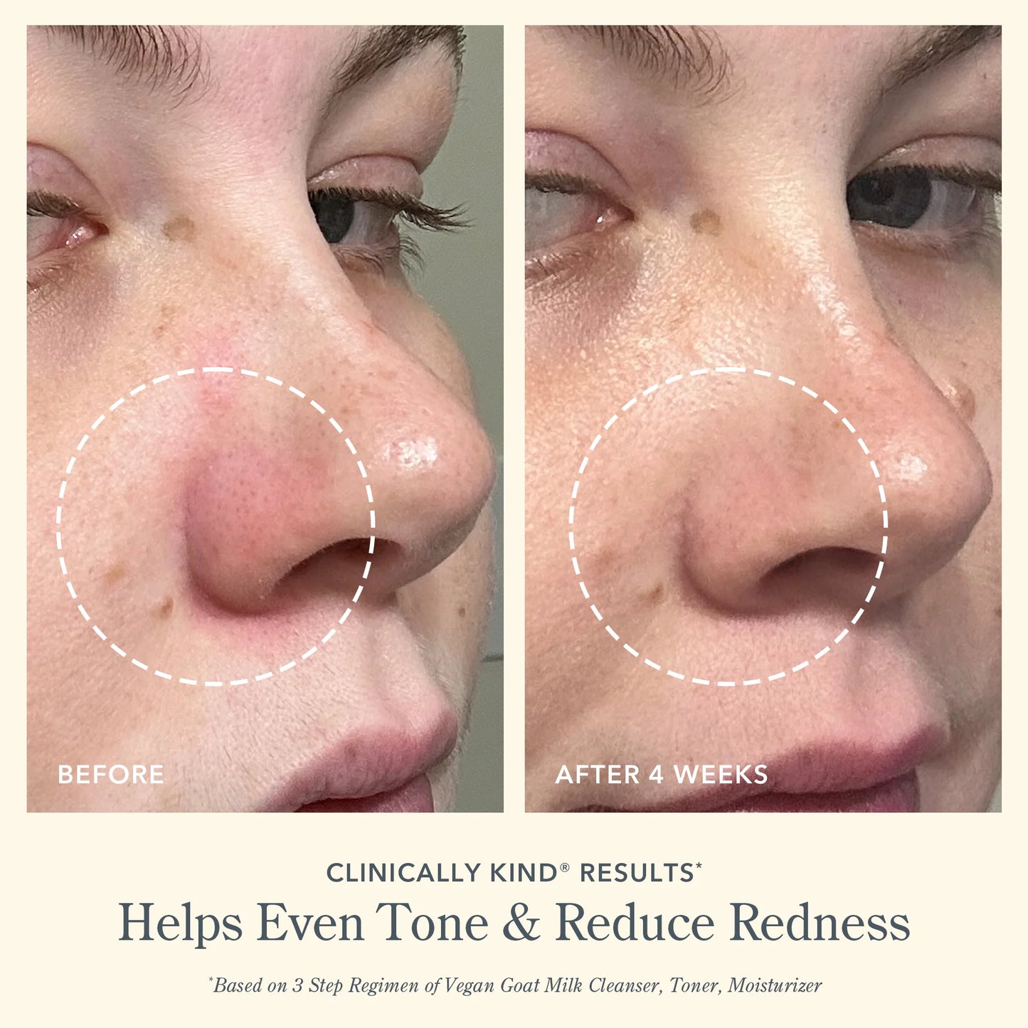 BEEKMAN Oily/Combination Skin Facial Toner