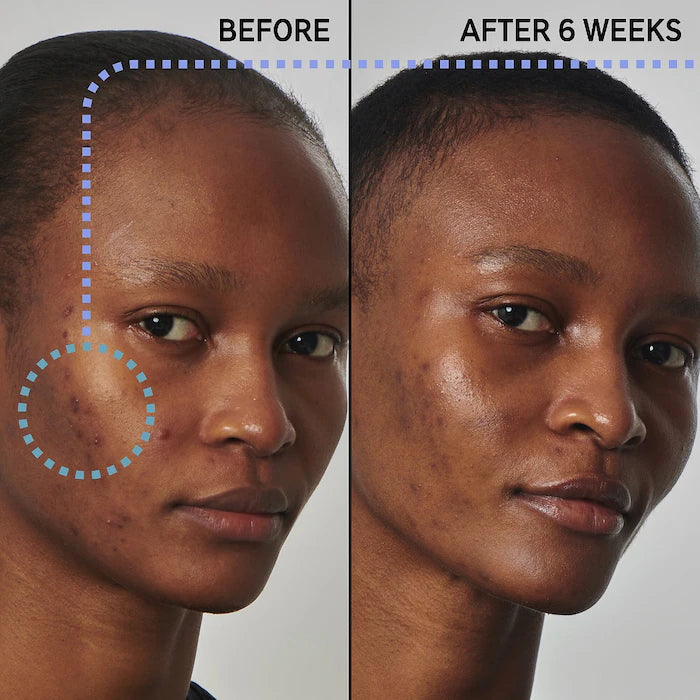 The Inkey List Serum Niacinamide 20%