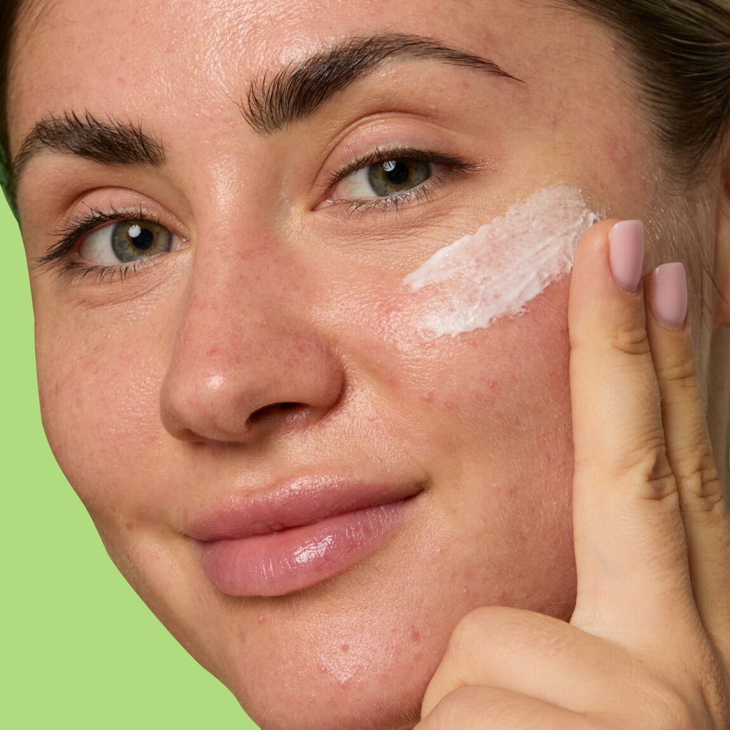 Good Molecules 10% Azelaic Acid Treatment