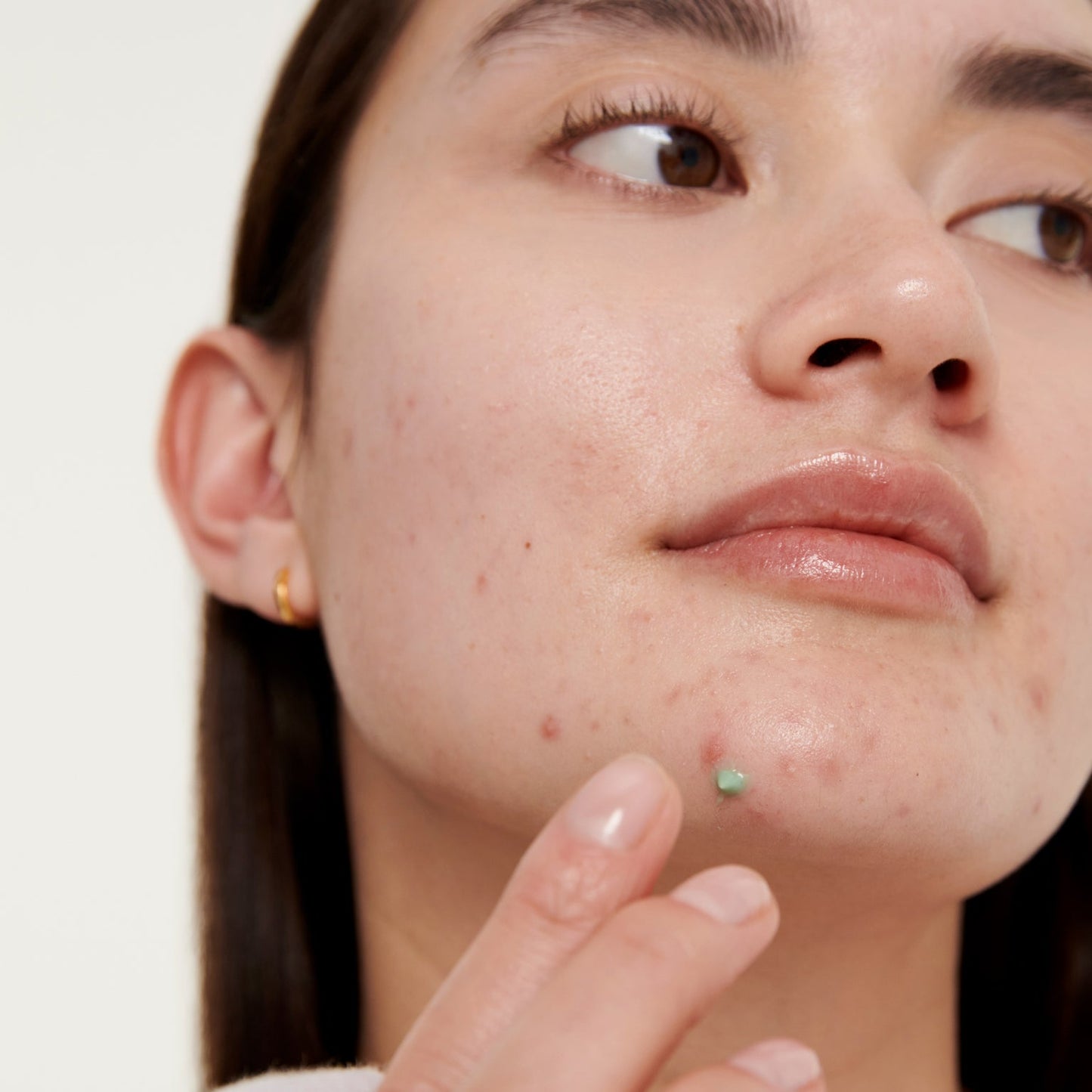 The Inkey List Succinic Acid Acne Treatment