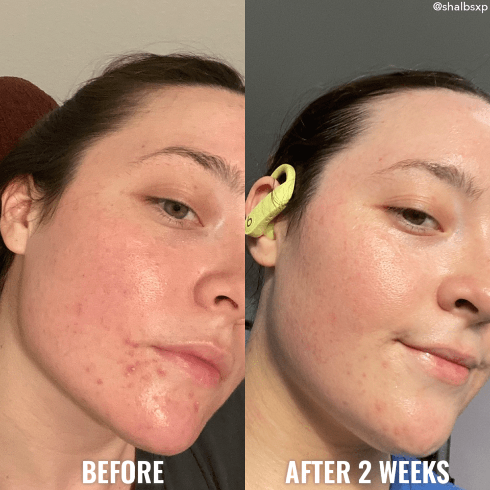 Clarify &Cleanse Bar Good Molecules