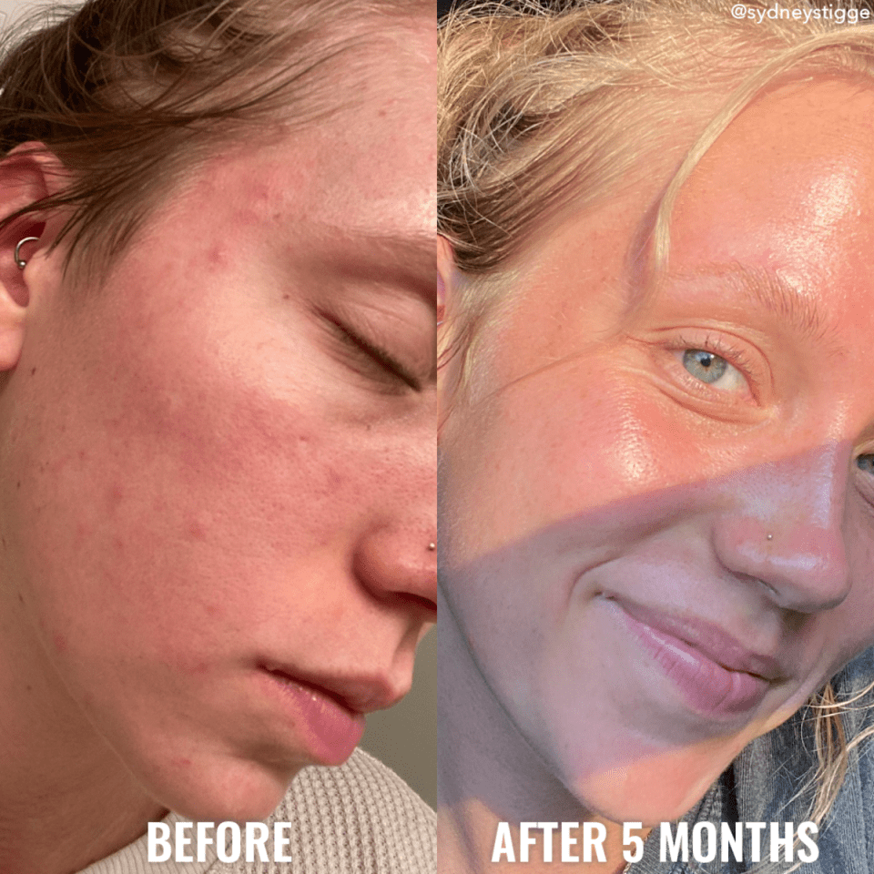 Crema en Gel Clarificante BHA Good Molecules