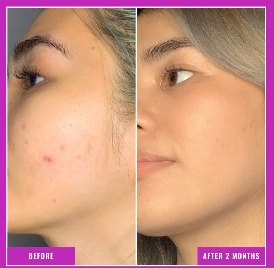Gentle Cream Retinol Good Molecules