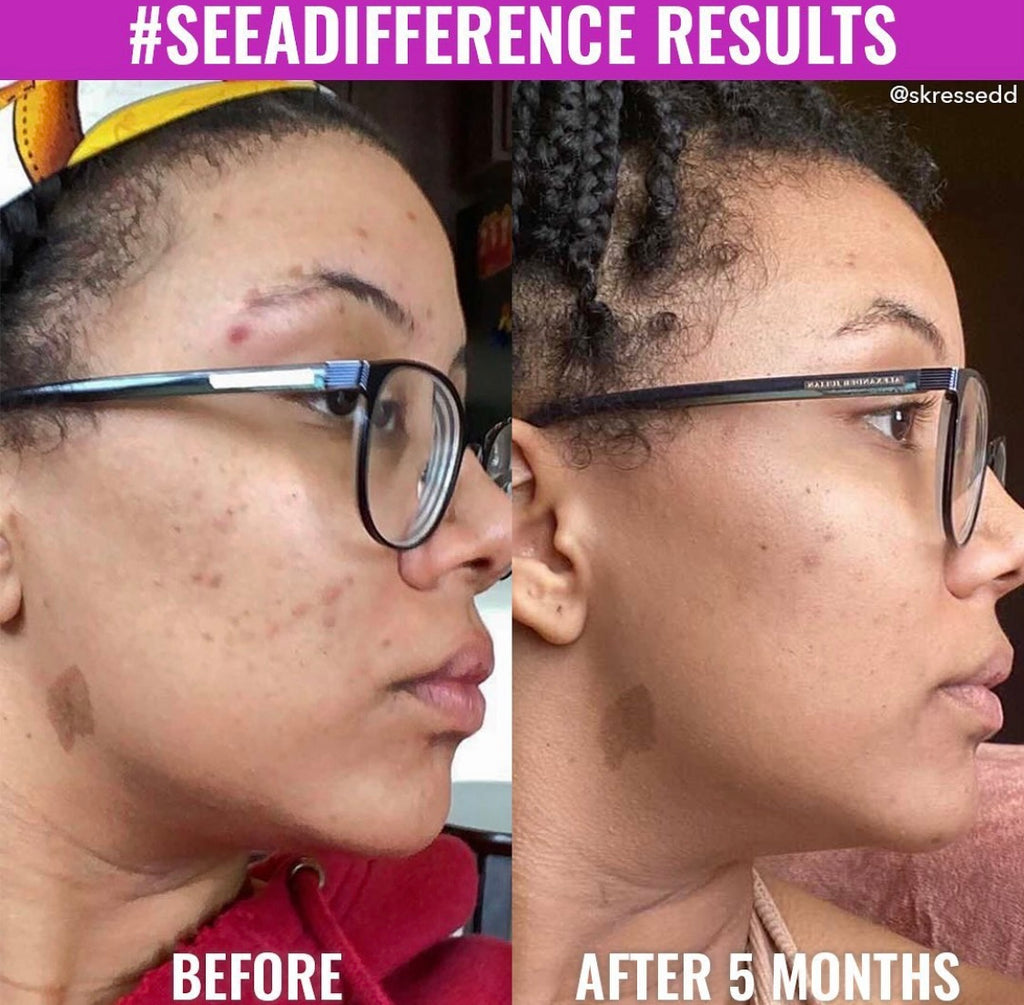 Discoloration Correcting Serum Good Molecules